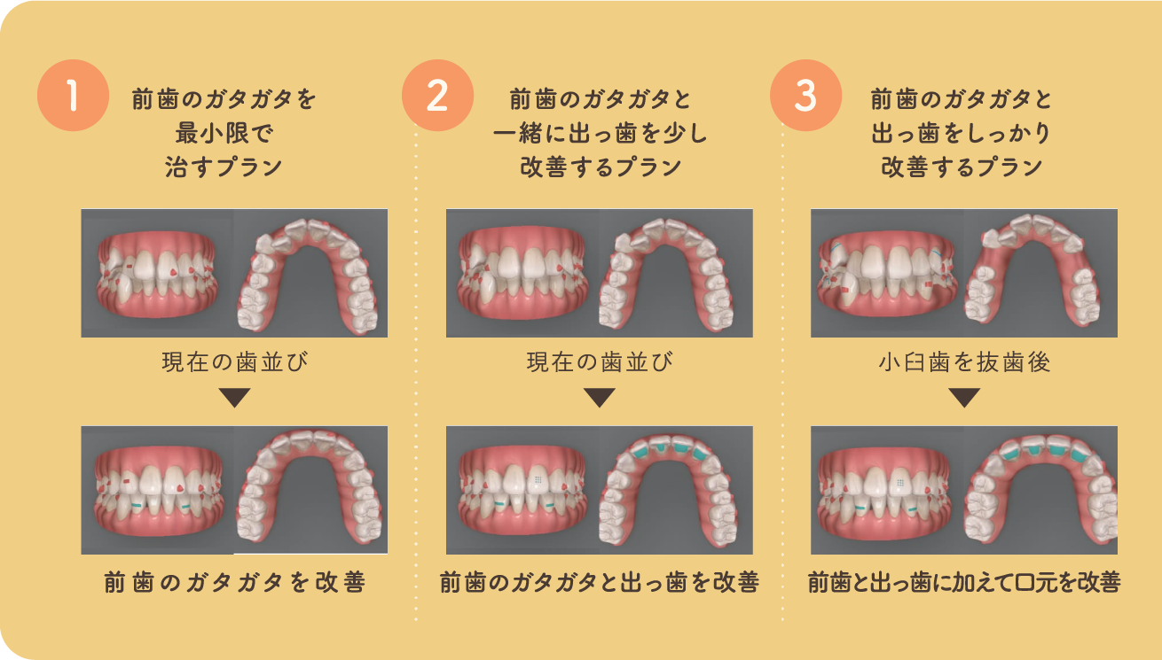 患者様のニーズに応えられる様々なプラン