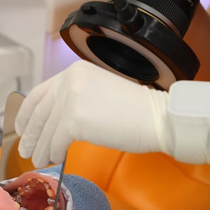 口腔内デジタルカメラ