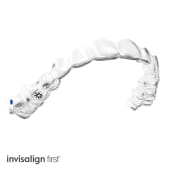 マウスピース矯正