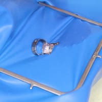 ラバーダム防湿法