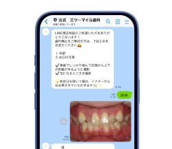 スマートフォンでLINE無料矯正相談