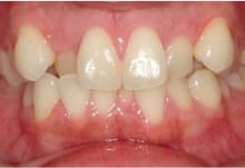 事前にお口の写真を送信