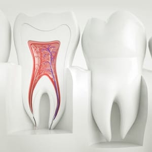 歯を失う可能性のある歯周病