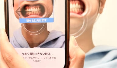 口腔内の写真を撮って送信