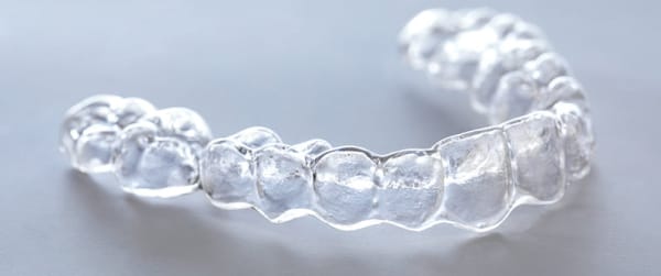 マウスピース矯正