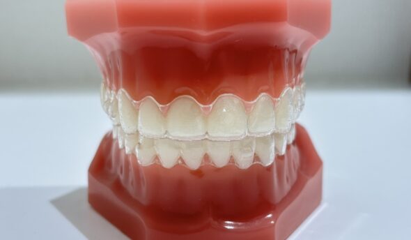 マウスピース矯正とワイヤー矯正を徹底比較。それぞれのメリットと判断基準を紹介