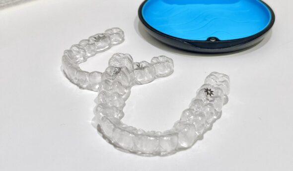 マウスピース矯正の種類を徹底解説｜それぞれの特徴・費用・選び方を紹介