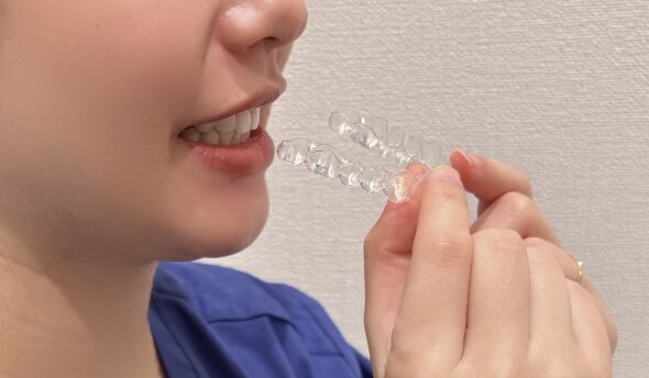 マウスピース矯正後は元に戻るって本当？後戻りを防ぐためのポイント5つ